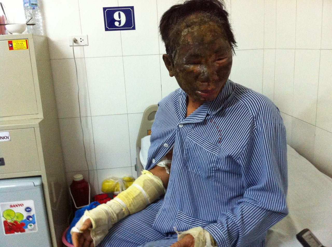 Vụ luật sư Trần Hồng Lĩnh ở Hải Phòng bị tạt axit: Đã khởi tố vụ án Cố ý gây thương tích