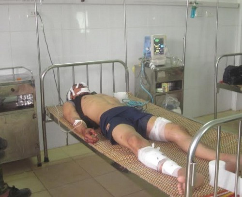 Hà Tĩnh: Tai nạn lao động 2 người chết, 3 người bị thương nặng