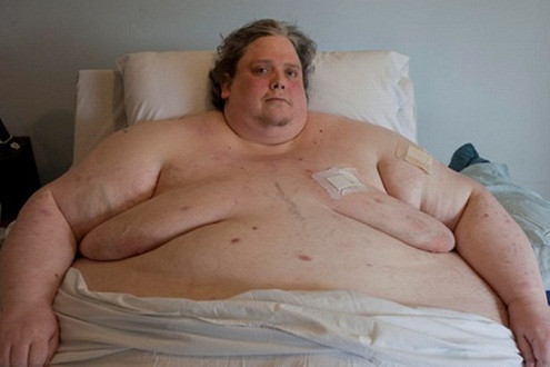 Người đàn ông béo nhất thế giới qua đời vì viêm phổi