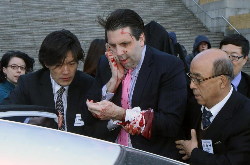 Seoul: Đại sứ Mỹ tại Hàn Quốc bị tấn công bằng dao cạo