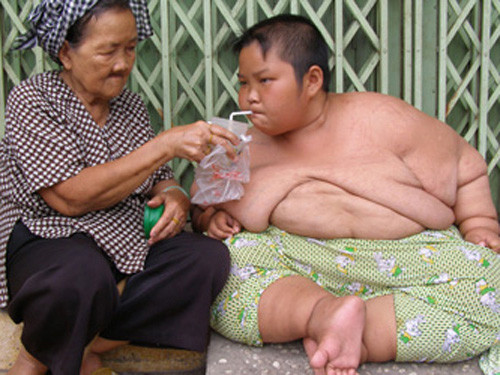 25% dân số Việt Nam đang bị thừa cân béo phì