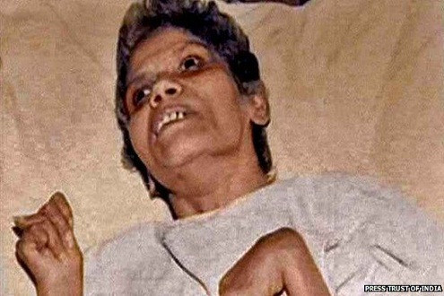 Ấn Độ: Nữ y tá bị hiếp dâm, sống đời sống thực vật 42 năm đã qua đời