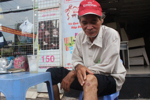 Tai nạn rình rập trên con đường hiện đại nhất Sài Gòn