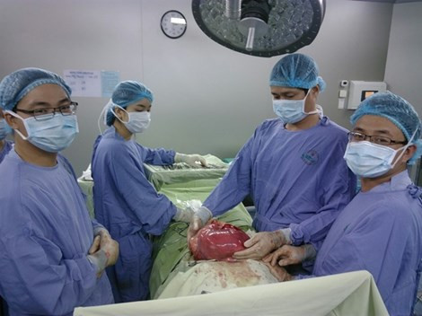 Tin tức sức khỏe ngày 5/8: Phẫu thuật lấy khối u nặng 6,5kg ra khỏi cơ thể