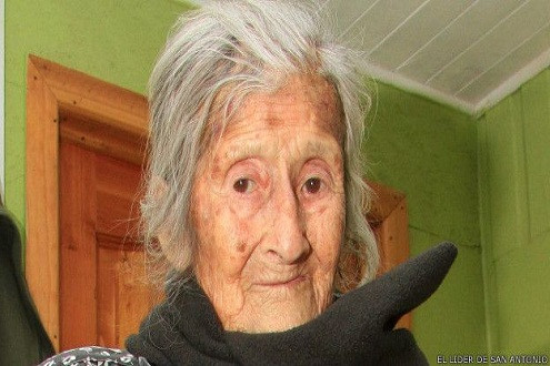 Phát hiện bào thai 60 năm trong bụng cụ bà 91 tuổi