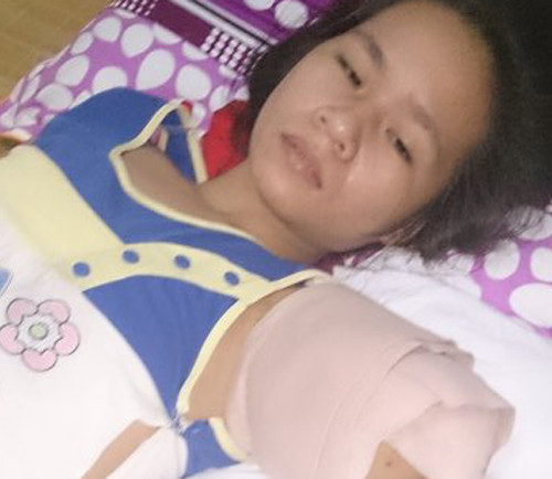 Nghệ An: Đi tham quan, một phụ nữ bị hổ vồ đứt cánh tay