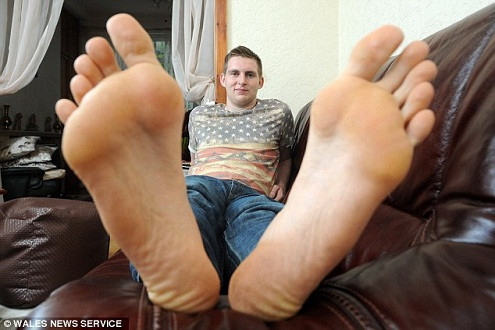 Chuyện về anh chàng có đôi bàn chân dài nhất nước Anh