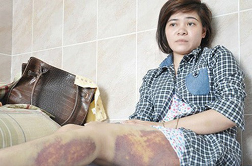 Tây Ninh: Kỷ luật Trung tá công an đánh dã man nữ công nhân