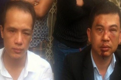 Công an Hà Nội khởi tố vụ án hai luật sư bị hành hung giữa đường