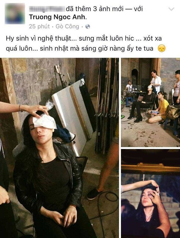 Trương Ngọc Ánh gặp tai nạn trên phim trường 