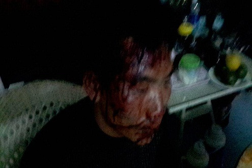 Ninh Bình: Côn đồ hành hung tài xế và phụ xe chảy máu đầu