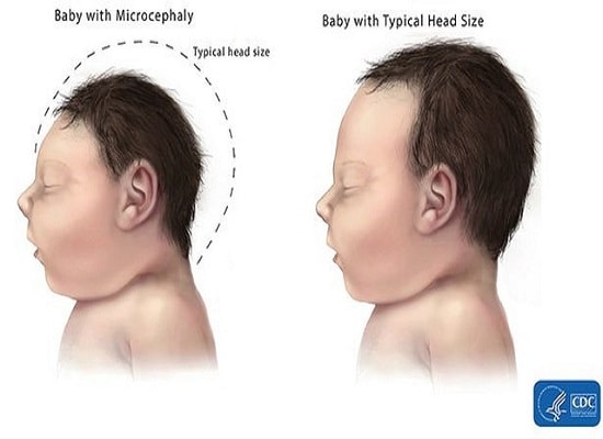 Bao giờ có vắc-xin diệt virus Zika?