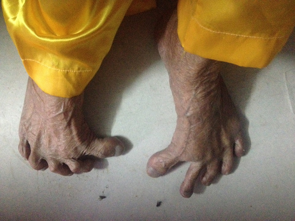 Bí quyết sống thọ của cụ ông 104 tuổi có bàn chân Giao Chỉ