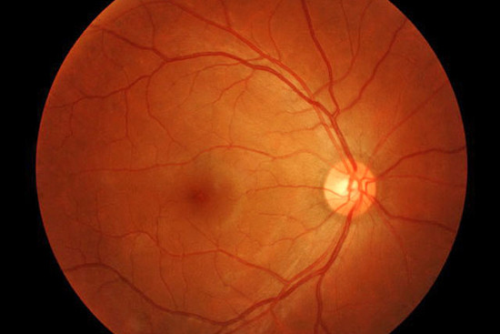 Hệ thống AI của Google tham gia nghiên cứu bệnh về mắt