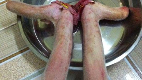 Mất chức năng đàn ông vì... nhung hươu