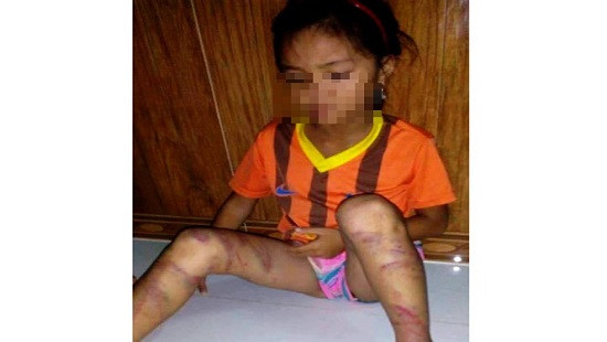 Quảng Bình: Bé gái 8 tuổi bị cha đẻ bạo hành dã man