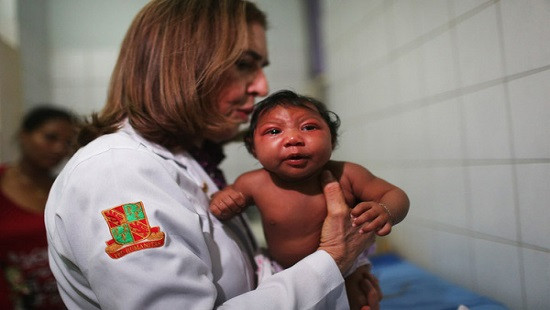 Bộ Y tế khẳng định trẻ đầu tiên ở Việt Nam mắc chứng đầu nhỏ nghi liên quan đến vi rút Zika