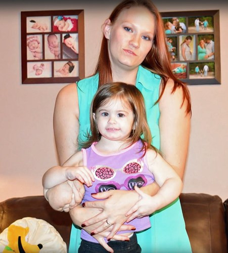 Bé gái 2 tuổi sống sót kì diệu với khối u nặng 2kg