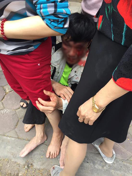 Hà Nội: Dân đánh trọng thương 3 người đàn ông vì nghi trộm xe SH 