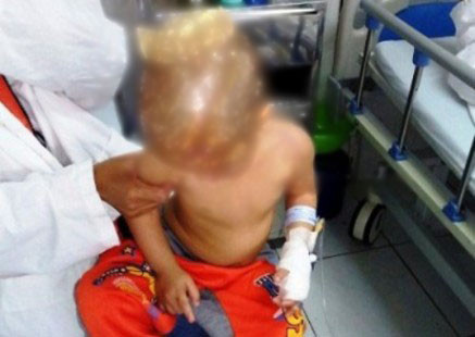 Thanh Hóa: Cháu bé 3 tuổi suýt mất mạng vì chó dữ tấn công