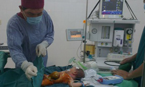 Đồng Nai: Bé sơ sinh bị dị tật gan nằm ngoài ổ bụng hiếm gặp