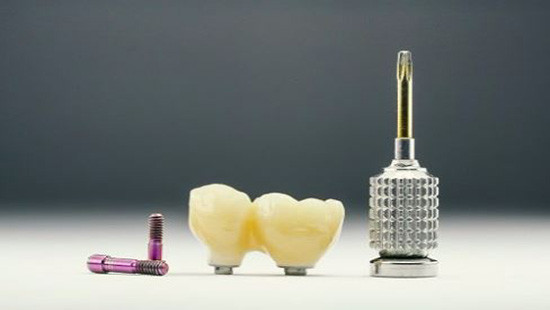 Nha khoa Đông Nam: Miễn phí răng sứ trên implant trị giá 1.000.000 đồng