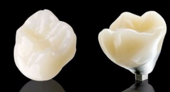 Nha khoa Đông Nam: Miễn phí răng sứ trên implant trị giá 1.000.000 đồng