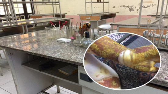 Vụ nổ trong phòng thí nghiệm: Cô giáo và 4 học sinh bị kỷ luật