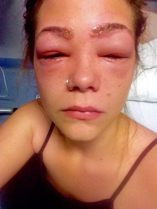 Cô gái 16 tuổi suýt mù mắt vì nhuộm lông mày