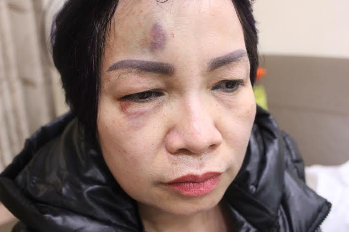 Công an phường Ngọc Khánh (Ba Đình, Hà Nội): Cần xử lý nghiêm vụ việc liên tiếp đánh người