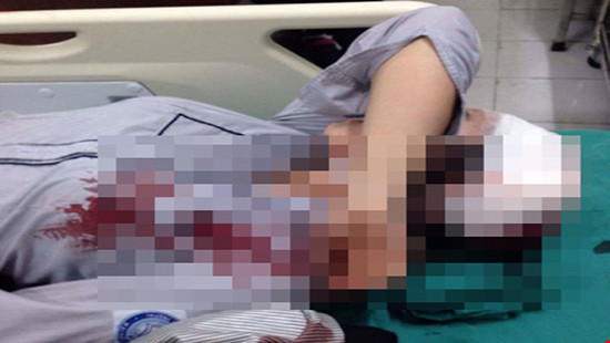 Hà Nội: Nữ sinh bị hành hung ngất xỉu tại chỗ