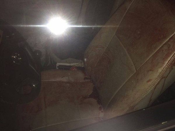 Quảng Nam: Tài xế taxi bị đâm gần chục nhát dao trong đêm