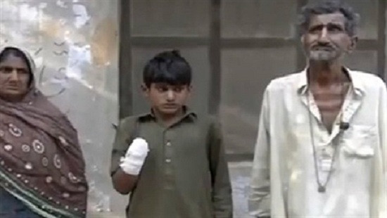 Pakistan: Cậu bé 13 tuổi bị chủ lao động chặt tay để “dạy dỗ”