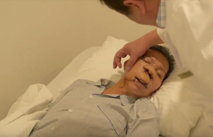 ‘Phép màu’ trả lại gương mặt cho người 10 năm bị ung thư da