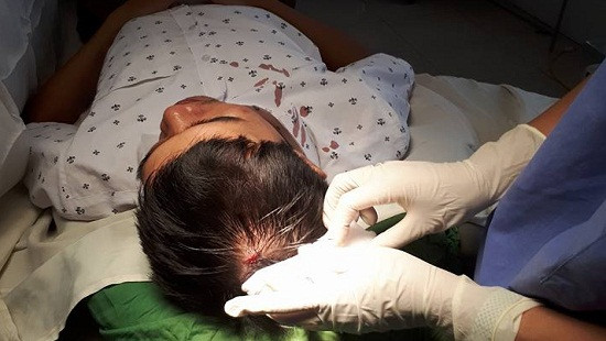 Bộ Y tế lên tiếng vụ bác sĩ bị hành hung chảy máu đầu