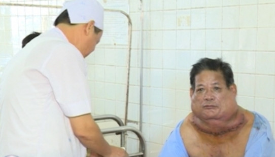 Thanh Hóa: Phẫu thuật thành công bệnh nhân bị đau mỡ vùng cổ