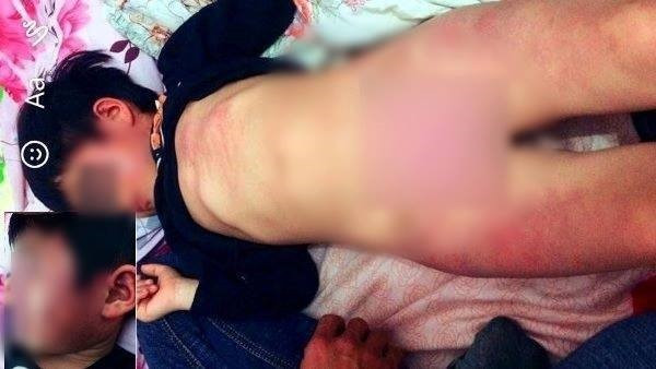 Vụ bé 4 tuổi ở Bắc Giang bị đánh bầm tím khắp người: Cơ quan chức năng lên tiếng