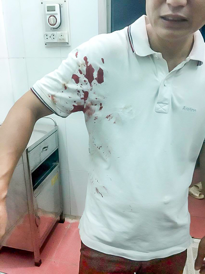 Vụ chém người gây thương tích ở Bắc Giang: Không khởi tố vụ án là chưa thỏa đáng