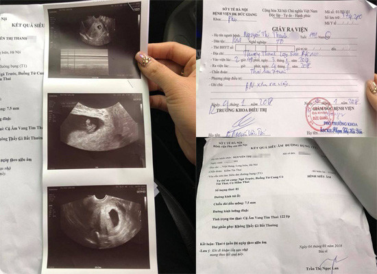 Bác sĩ chẩn đoán nhầm khiến thai phụ suýt mất con