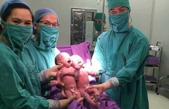 Niềm vui chào đón 2 bé sinh đôi cùng trứng nhờ thụ tinh ống nghiệm