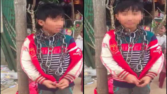 Thanh Hóa: Bé trai 13 tuổi bị xích quấn quanh cổ