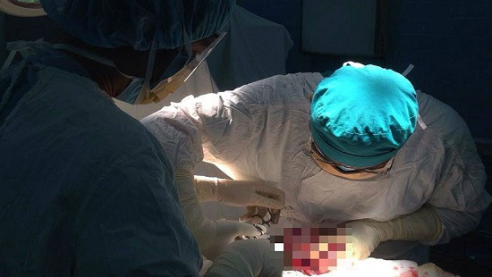 Nín thở ca phẫu thuật khối u 6kg cho bệnh nhân HIV