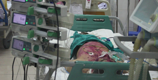 Sơn La: Một bệnh nhân mắc thủy đậu biến chứng nguy kịch