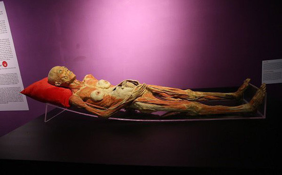 Triển lãm cơ thể người: Bộ Văn hóa yêu cầu báo cáo