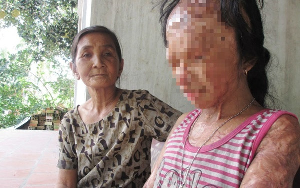 Bà nội muốn xin đôi mắt của Nguyễn Hữu Tình cho cháu gái bất hạnh