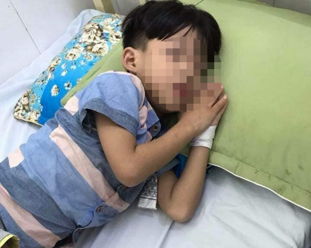Vụ bé trai 5 tuổi bị chó cắn: Tử vong không phải do bệnh dại