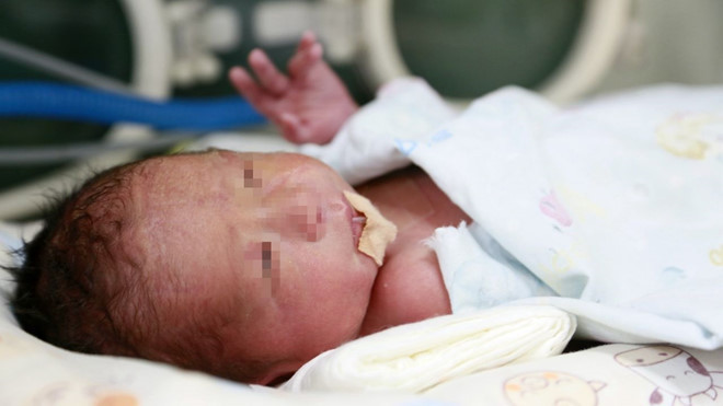 Em bé đầu tiên ở Trung Quốc sinh ra từ tử cung cấy ghép