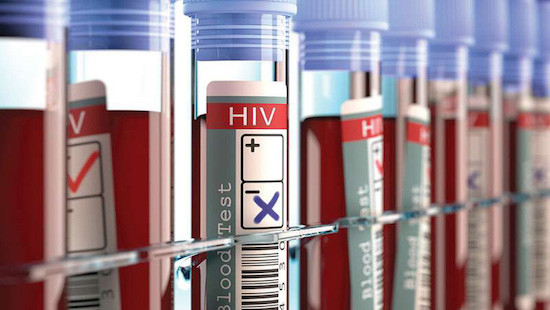 Người thứ 3 trên thế giới được chữa khỏi HIV