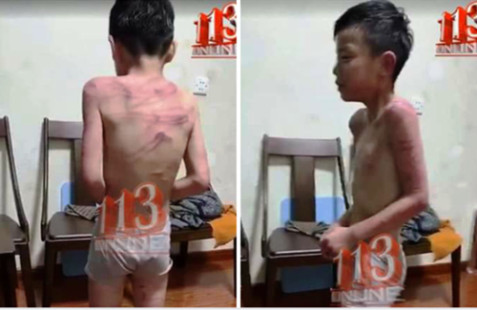Xác minh thông tin bé trai bị bạo hành tại Thanh Hóa