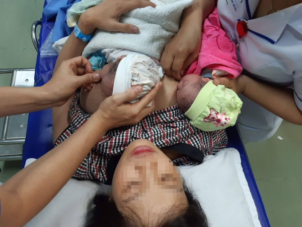 Sản phụ sinh đôi, một bé chào đời ở nhà, một bé sinh ở bệnh viện